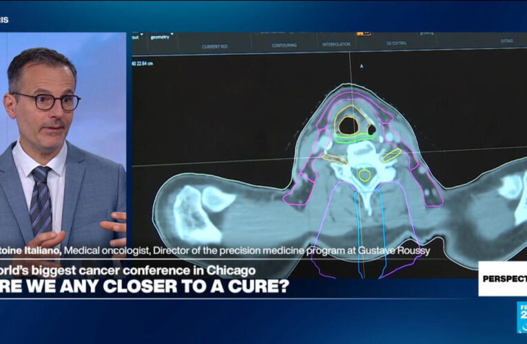 ‘We must do more in terms of cancer prevention,’ leading oncologist says